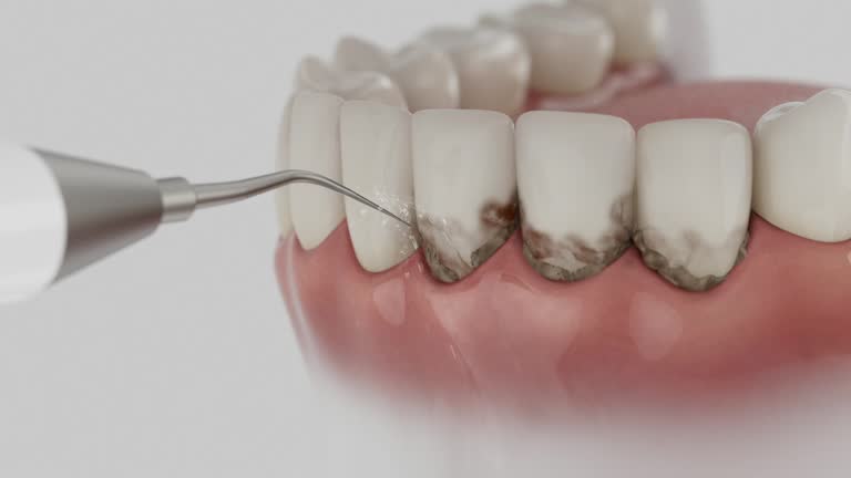 Trusted Tooth Extraction service in Eagle, ID - Dentist Open Now